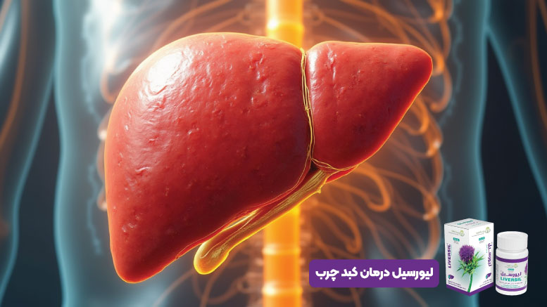 درمان کبد چرب با روش های طبیعی و علمی